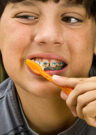 img-trmnt-braces-life-02