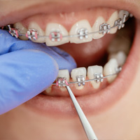 thumb-trmnt-braces-emergency-03