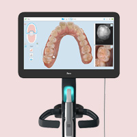 thumb-trmnt-invis-itero-04