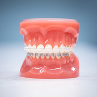 thumb-trmnt-ortho-allages-01