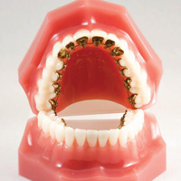 thumb-trmnt-ortho-allages-03