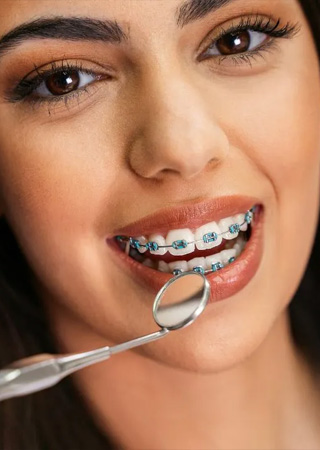 img-trmnt-typesofbraces-01