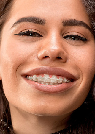 img-trmnt-typesofbraces-02